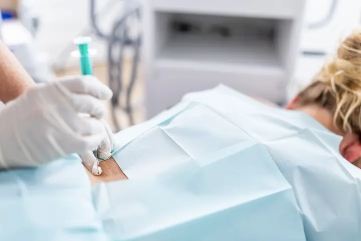 Infiltrationstherapie Bild von Spritzeninjektion in Rücken