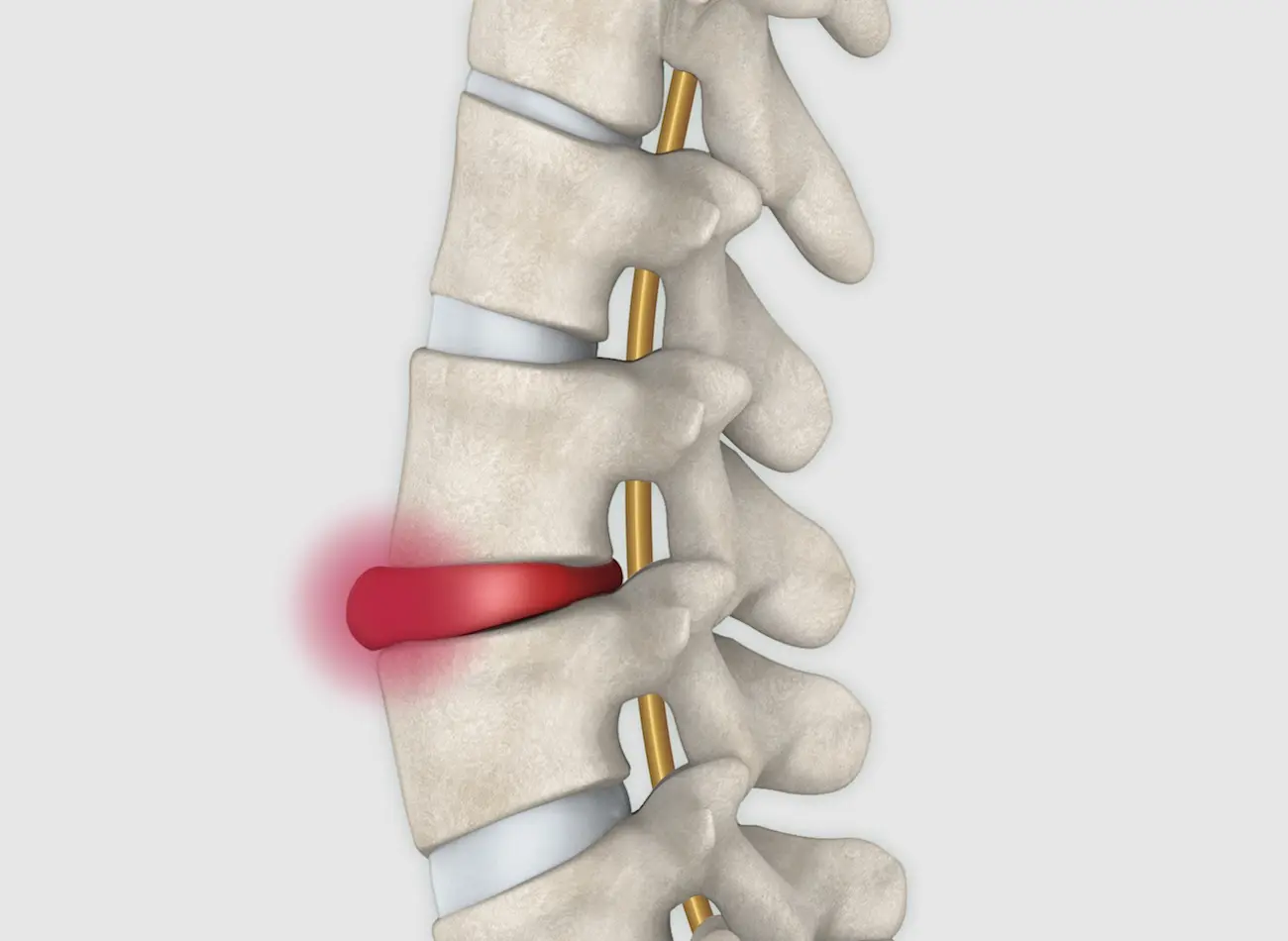 Lendenwirbelsaeule Bandscheibenpraxis